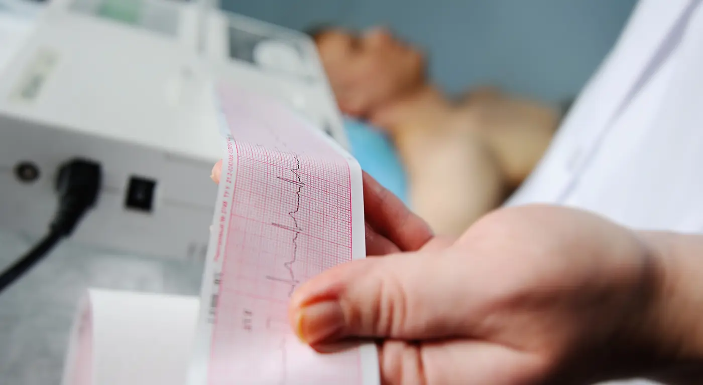 12-lead Electrocardiogram (ECG)